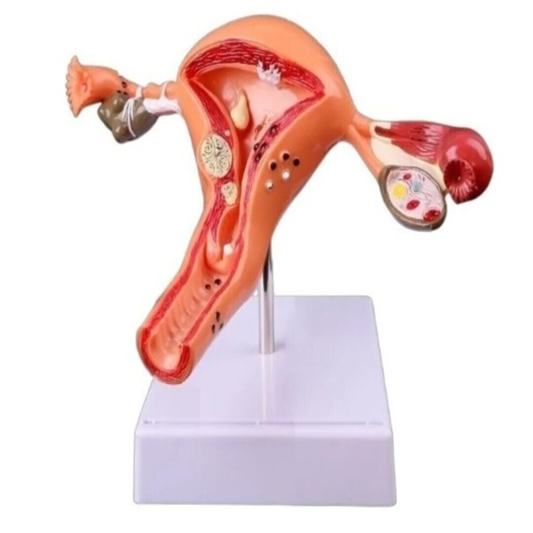 MODELO DE ÚTERO, ÓRGANO REPRODUCTOR FEMENINO